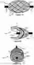 Fig. 08 - Vessel occluder