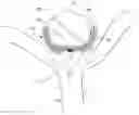 Fig. 01 - Occlusion device