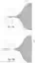 Fig. 06 - Occlusion device