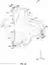 Fig. 02 - Distal radial compression device