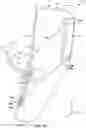 Fig. 02 - Ulnar compression device