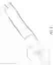 Fig. 04 - Radially-firing electrohydraulic lithotripsy probe