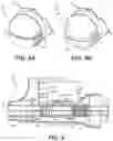 Fig. 06 - Medical tools for and methods of gaining access to extra vascular spaces