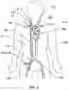 Fig. 07 - Systems and methods for vascular access