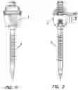Fig. 02 - Surgical access port