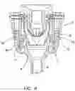 Fig. 05 - Surgical access port