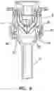 Fig. 07 - Surgical access port
