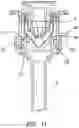 Fig. 09 - Surgical access port