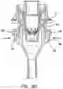Fig. 16 - Surgical access port
