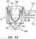 Fig. 40 - Surgical access port