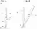 Fig. 04 - Apparatus for closed reduction of bone fracture