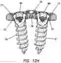 Fig. 35 - Anterior cervical plate