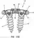 Fig. 43 - Anterior cervical plate