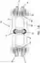 Fig. 45 - Anterior cervical plate