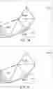 Fig. 09 - Dynamic implant fixation plate