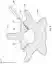 Fig. 07 - Expandable facet joint fixation device