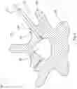 Fig. 08 - Expandable facet joint fixation device