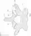 Fig. 09 - Expandable facet joint fixation device