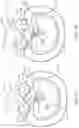 Fig. 08 - Interspinous process device and method