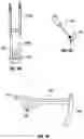 Fig. 04 - Percutaneous Transverse Connector System