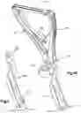 Fig. 07 - Bi-planar persuader