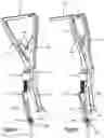 Fig. 08 - Bi-planar persuader