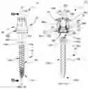 Fig. 02 - Modular spinal fixation device