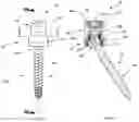 Fig. 06 - Modular spinal fixation device