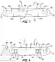 Fig. 07 - METHOD AND APPARATUS FOR A CONTINUOUS COMPRESSION IMPLANT