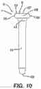 Fig. 09 - METHOD AND APPARATUS FOR A CONTINUOUS COMPRESSION IMPLANT