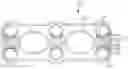Fig. 01 - Cervical plate and screw locking mechanism