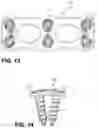 Fig. 06 - Cervical plate and screw locking mechanism