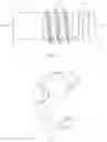 Fig. 09 - Active compression devices, methods of assembly and methods of use
