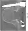 Fig. 32 - Torque-limiting screwdriver devices, systems, and methods