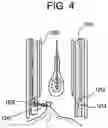 Fig. 04 - TISSUE RESECTION APPARATUS