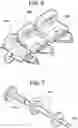 Fig. 06 - TISSUE RESECTION APPARATUS