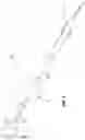 Fig. 03 - Ablation catheter tip