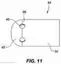 Fig. 11 - Ablation catheter tip