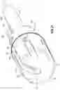 Fig. 18 - Ablation catheter tip