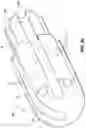 Fig. 20 - Ablation catheter tip