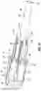 Fig. 27 - Ablation catheter tip