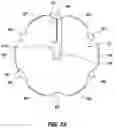 Fig. 28 - Ablation catheter tip
