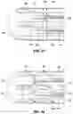 Fig. 29 - Ablation catheter tip