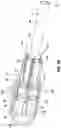 Fig. 30 - Ablation catheter tip