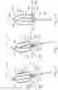 Fig. 10 - UNIPOLAR REFERENCE ELECTRODE FOR ELECTROPHYSIOLOGY MAPPING CATHETER