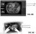 Fig. 08 - System and method for multi-probe guidance