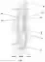 Fig. 02 - Systems and methods for spinal correction surgical planning