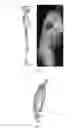 Fig. 03 - Systems and methods for spinal correction surgical planning