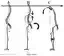 Fig. 04 - Systems and methods for spinal correction surgical planning