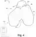 Fig. 05 - Interactive anterior-posterior axis determination